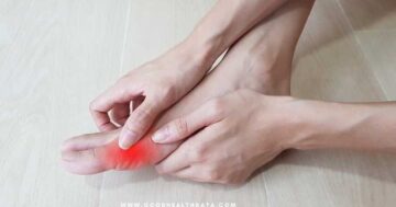 โรคเก๊าท์