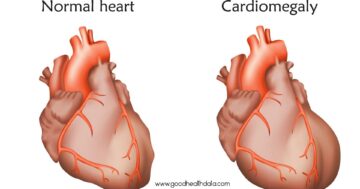 ภาวะหัวใจเต้นเร็ว