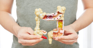 การใส่สายอาหารทางหน้าท้อง