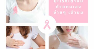 วิธีการตรวจมะเร็งเต้านม