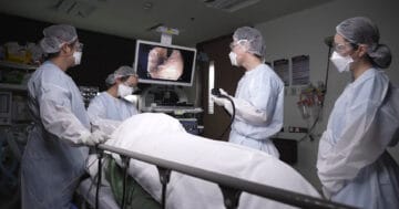 มะเร็งลำไส้ใหญ่