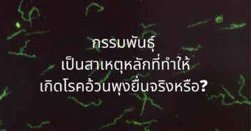 กรรมพันธุ์-เป็นสาเหตุหลักที่ทำให้-เกิดโรคอ้วนพุงยื่นจริงหรือ