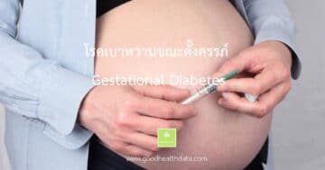 โรคเบาหวานขณะตั้งครรภ์