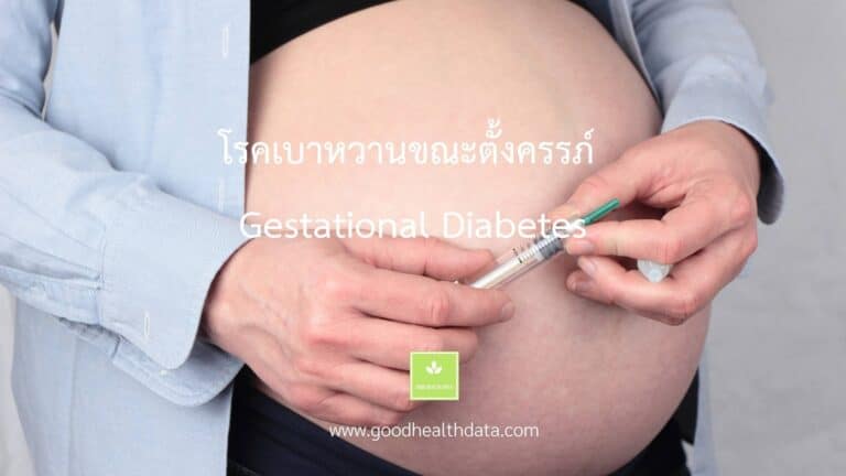 โรคเบาหวานขณะตั้งครรภ์